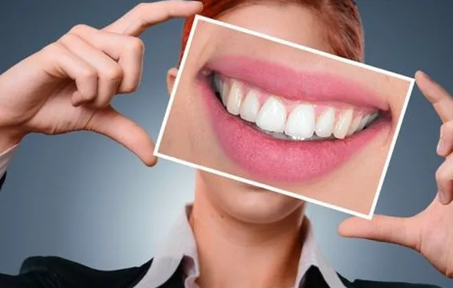 Conheça os 6 melhores tratamentos para ter os dentes perfeitos