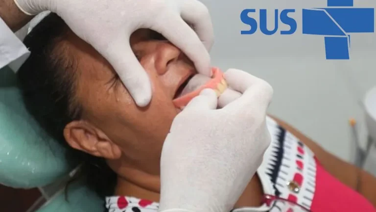 Implante dentário gratuito pelo SUS? Descubra como agora!
